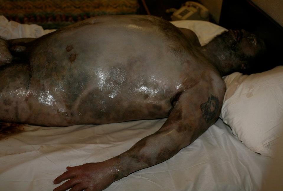 Decomposing Body – Vincent Van Dyke Effects