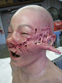 pathophysiology of head injury pdf